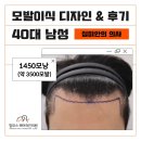 XQ Hair(엑스큐 헤어) | 탈모의 가족력(유전), 40대 남자 모발이식 2주 경과 후기