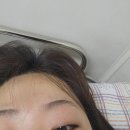 미음야구장 | 난소기형종 복강경 수술 후기 .. (입원전, 3박 4일 입원기, 퇴원)