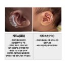내돈내산 신생아 아기 엘프 귀접힘 셀프 귀교정 시기와 후기