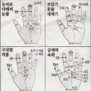 수지침 Daum카페