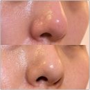 아르제이 뷰티에서 세멘부스팅먼트 피부관리 체험 후기