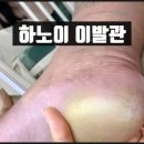 힐링이발관