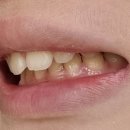 연세엔서울치과교정과치과의원 이미지