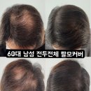 시흥,안산 탈모커버 두피문신 최대 50%할인 연말 연초 할인이벤트 8118스칼프 이미지