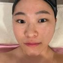 금곡동 피부관리 민에스테틱 알포유R4U 에너지테라피 써마트릭스 케어 받은 후기