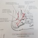 발목 염좌 치료 이미지