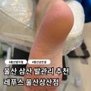울산발각질 레푸스 울산삼산점 관리 후기