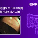 아이넥스