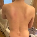 최프로 스킨 앤 바디 이미지