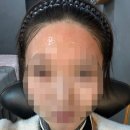 위례 왁싱 모모앤제이 본식 전 헤어라인왁싱 후기 (비포애프터 확실)