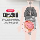 배 아픈 위치에 따라 다른 원인 이미지