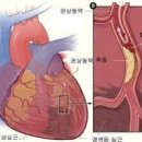 심장마비의 원인과 전조증상 이미지