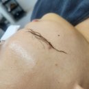 세라빌딩 | [경기/의정부] 깔달걀같은 빛나는 피부로 재탄생 오이유스킨 4세대 스킨플래닝 세라링 후기