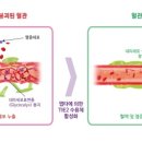 패혈증의 원인 증상, 치료 이미지