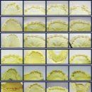 N치과기공소 이미지