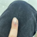 제일삼성정형외과의원 | 삼성본정형외과의원 정형외과 방문 후기