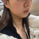 더웨이성형외과의원 | 소개팅주사 | 강남역 성형외과|이중턱 조지기.. |스테로이드 유무 차이