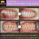 평촌심미치과의원 이미지