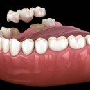 (주)브릿지 이미지