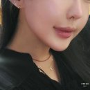 KJ 빌딩 | 가양역 피부과 온다 리프팅 8만줄 역대급 가격 효과 본 후기