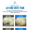 상하치과의원 네이버블로그