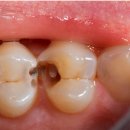 맑은미소치과의원 | 양평치과 과잉진료 걱정된다면