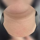 부천얼굴경락 이중턱 라인잡아주는 상동역 로비엘에스테틱
