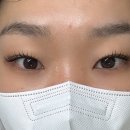 비니래쉬앤뷰티 이미지