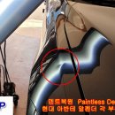 현대 아반테 앞펜더 각 부위 덴트복원 서울덴트복원 Paintless Dent Repair 이미지