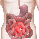 김소형한의원 네이버블로그