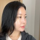 모드풀 | 마곡피부과 발산역인모드후기 인모드 FX 풀페이스 효과 대박 후기!