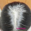 이광훈 | 볼빅 미토 코리아 탈모 샴푸로 머리숱을 풍성하게