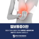 평택고덕본정형외과의원 | 평택 고덕 정형외과 팔꿈치 통증이 계속된다면