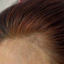 흥미헤어라인 이미지