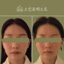 보령프라자 | 보령 피부관리샵 추천._.스킨포레스트 #웨딩관리#자세교정#리에이징