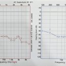 벨톤보청기 중곡지사 이미지