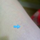 샤방뷰티 | 고주파 뷰티디바이스 추천, 내돈내산 트리폴라 홈케어 후기