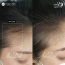 TWO 2 헤어 네이버블로그