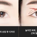 라이블리성형외과의원 이미지