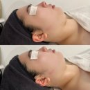당진 리프팅관리, 아르드뽀에스테틱 재방문 후기