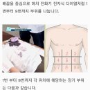 "위암 대장암 이 방법으로 98% 예방됩니다!" 집에서 매일 받는 셀프 내시경. 이미지