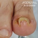 풋스올강남