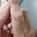 라파메디케어 이미지