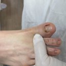 레푸스 감삼점&에이레네 이미지