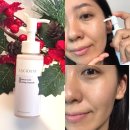 이로움메디컬 | 라시뎀 레드니스 큐어 부스팅 앰플 홍조앰플로 추천해요