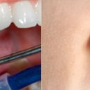 퍼즐치과기공소 이미지