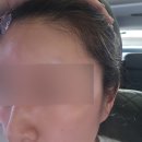 희헤어라인 네이버블로그