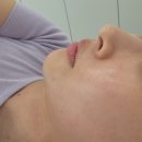 SK뷰 후문 앞 | 청주 슈퍼젝션 후기 여드름흉터 모공 개선 레티나 피아나뷰티랩