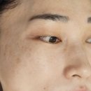 동탄대로21길 | 동탄에스테틱 허니블리 에스테틱 동탄점 히알플래닝 닥토필 후기