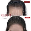 시티헤어라인